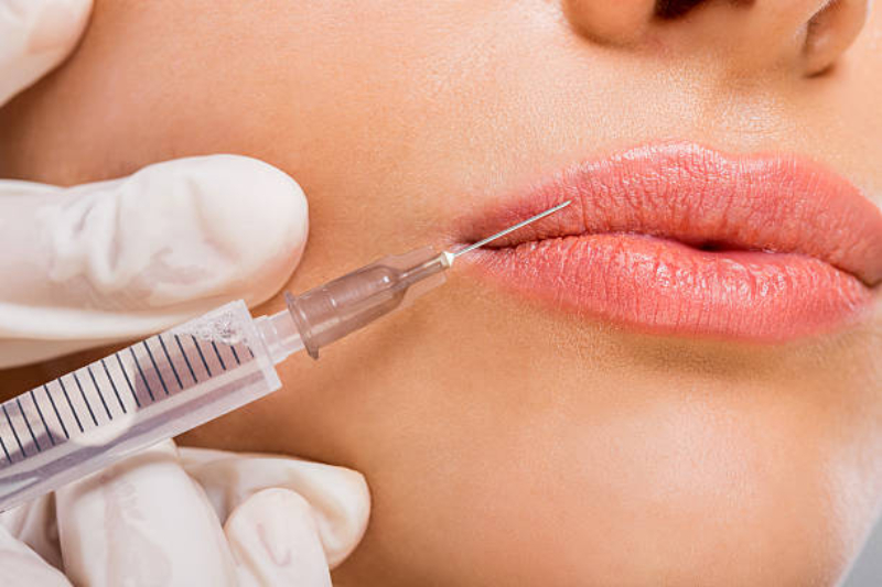 botox london