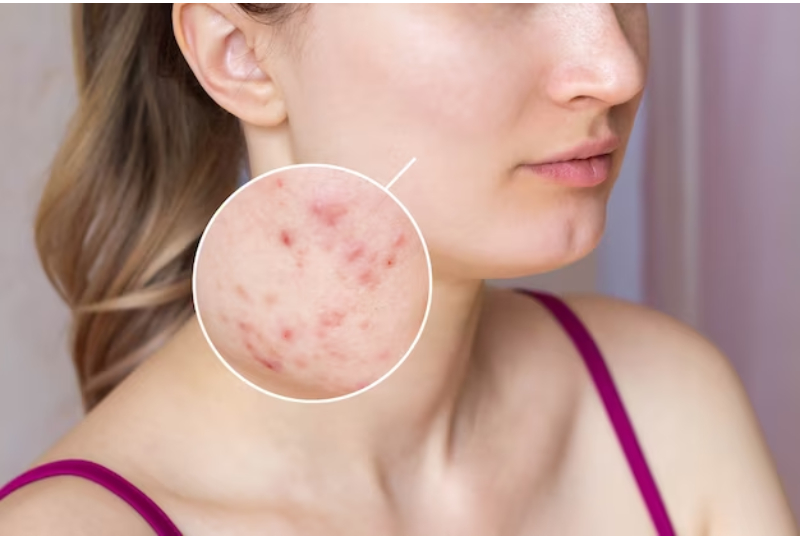Dermatology Care